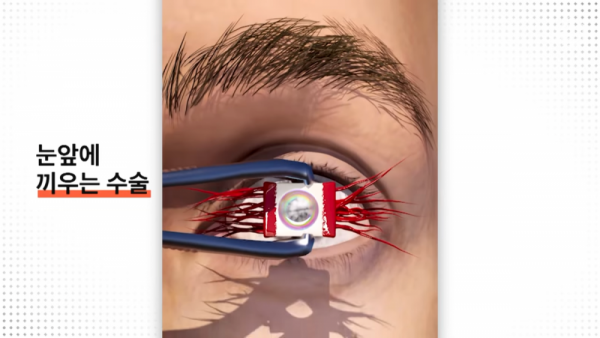 17518689000801.png